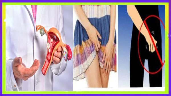 যৌনাঙ্গ চুলকানির কারণ, প্রতিকার ও হোমিওপ্যাথিক চিকিৎসা