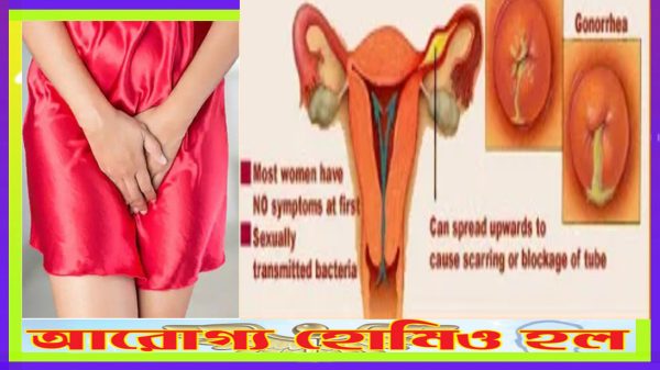 লিউকোরিয়ার কারণ, প্রতিকার ও হোমিওপ্যাথিক চিকিৎসা