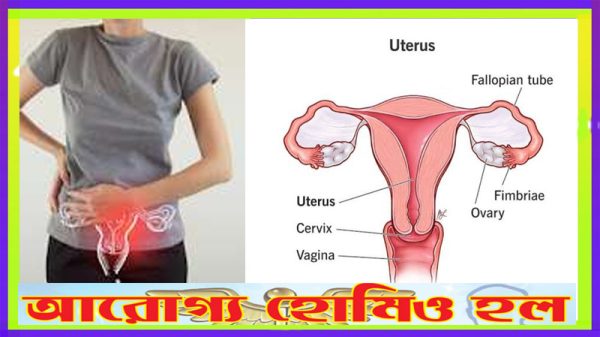 পি আই ডি (পেলভিক ইনফ্লামেটরি ডিজিজ) হোমিওপ্যাথিক চিকিৎসা