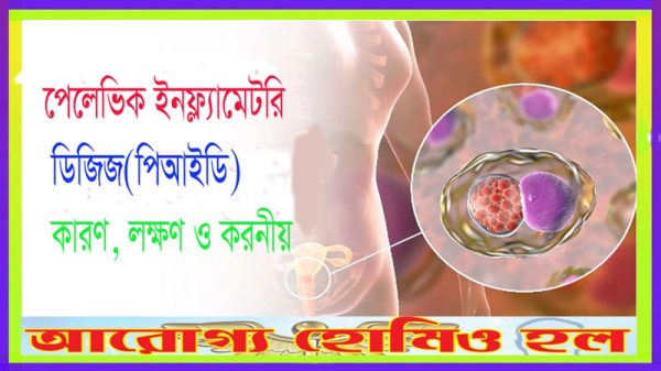 পেলেভিক-ইনফ্ল্যামেটরি-ডিজিজ-পিআইডি-কারণ-লক্ষণ-ও-করনীয়