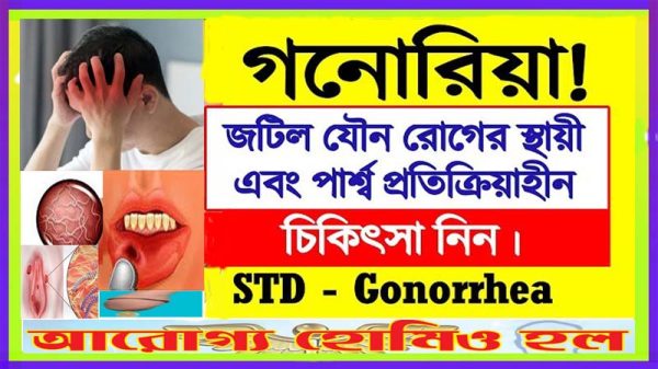 গনোরিয়া বা প্রমেহ ও হোমিওপ্যাথি ঔষধ
