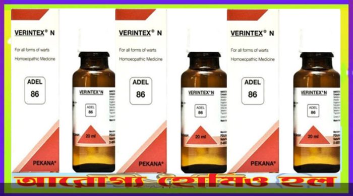 অ্যাডেল নং -৮৬ (আঁচিল)