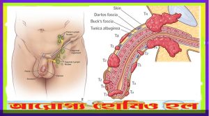 পুরুষাঙ্গের ক্যানসার