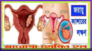 জরায়ু ক্যানসারের লক্ষণ