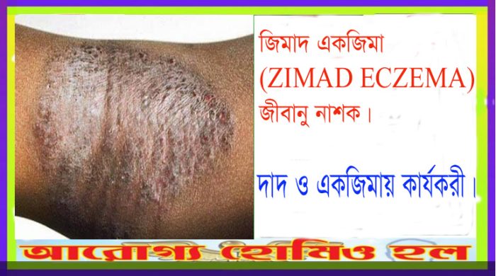 জিমাদ একজিমা-ZIMAD ECZEMA